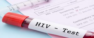 hıv, HIV, AIDS Beslenme diyet test